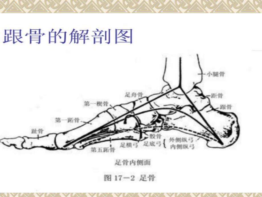 新建跟骨骨折的护理查房演示文稿.ppt_第3页