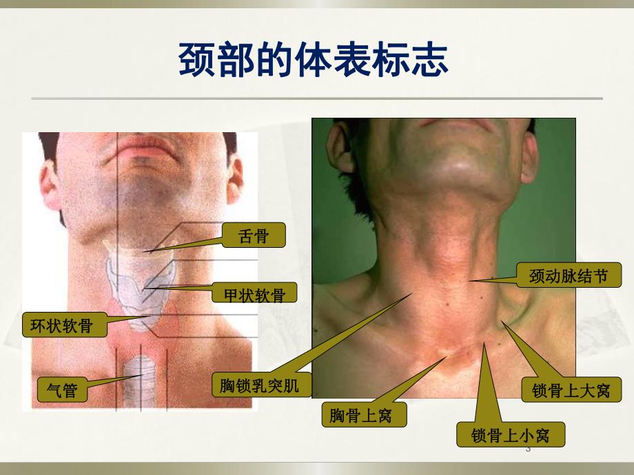 气管切开术精要.ppt_第3页