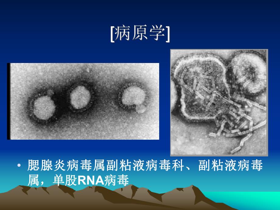 流行性腮腺炎幻灯.ppt_第3页