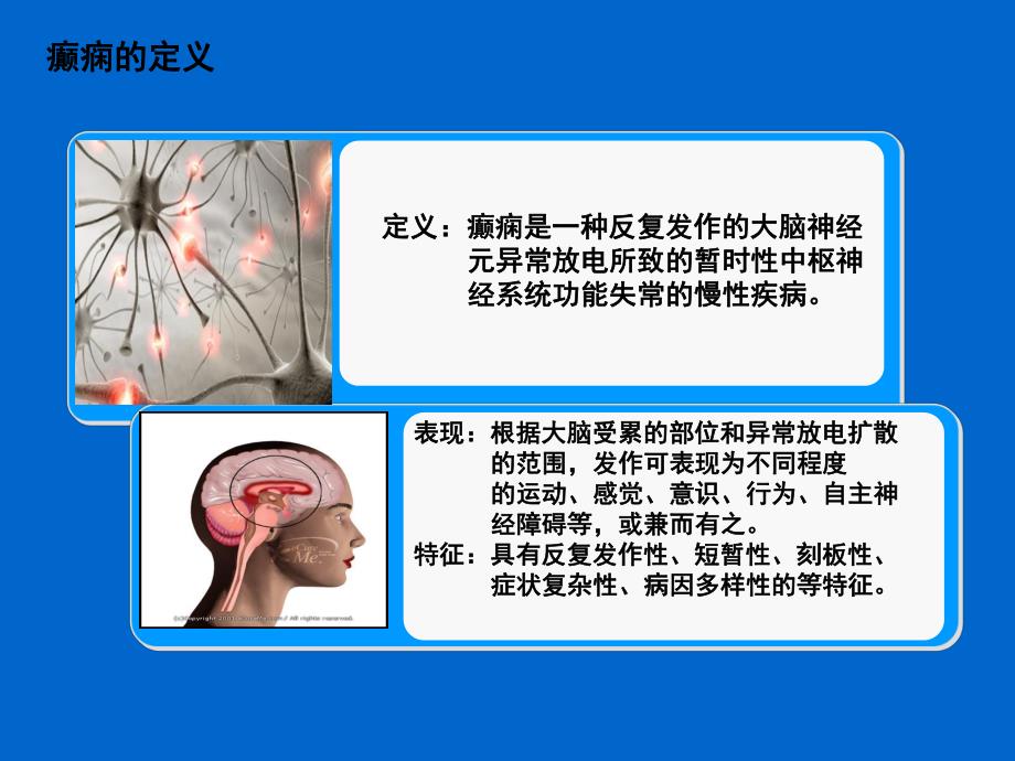 癫痫急救护理PPT.ppt_第3页