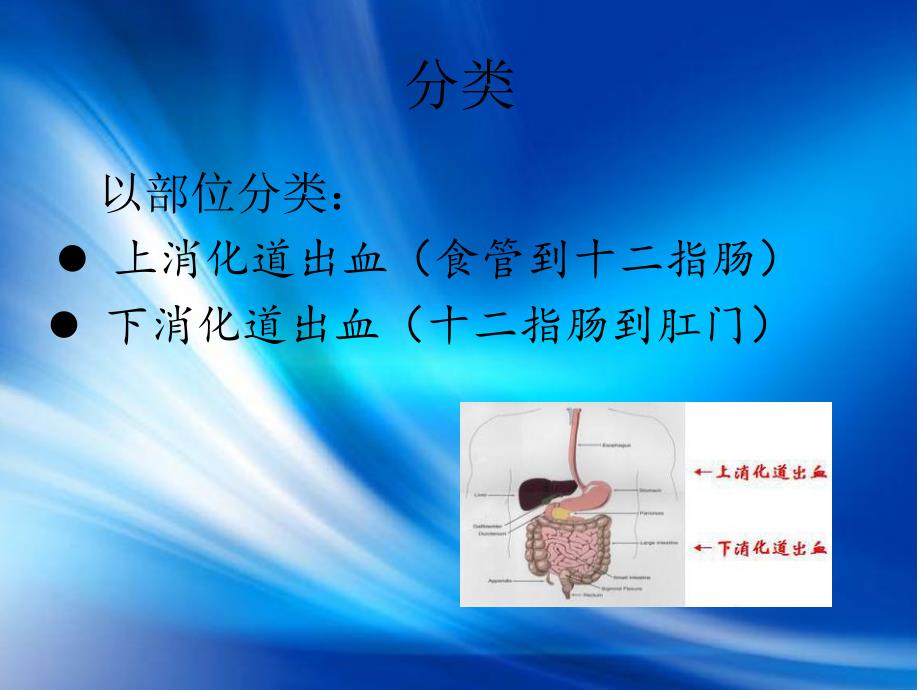 消化道出血的诊断.ppt_第3页