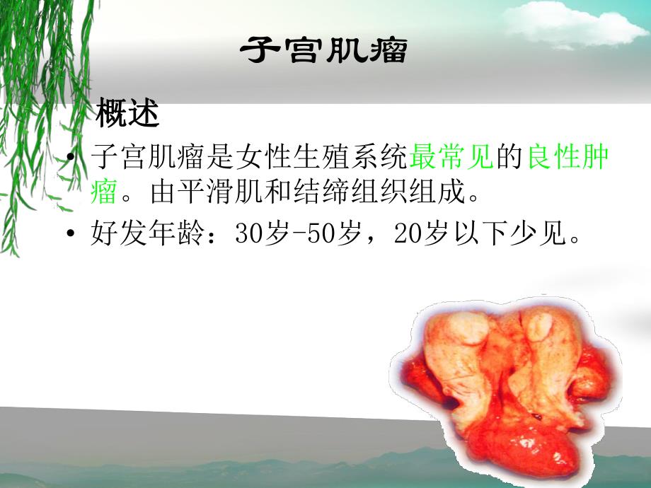 疾病查房—子宫肌瘤的护理.ppt_第3页