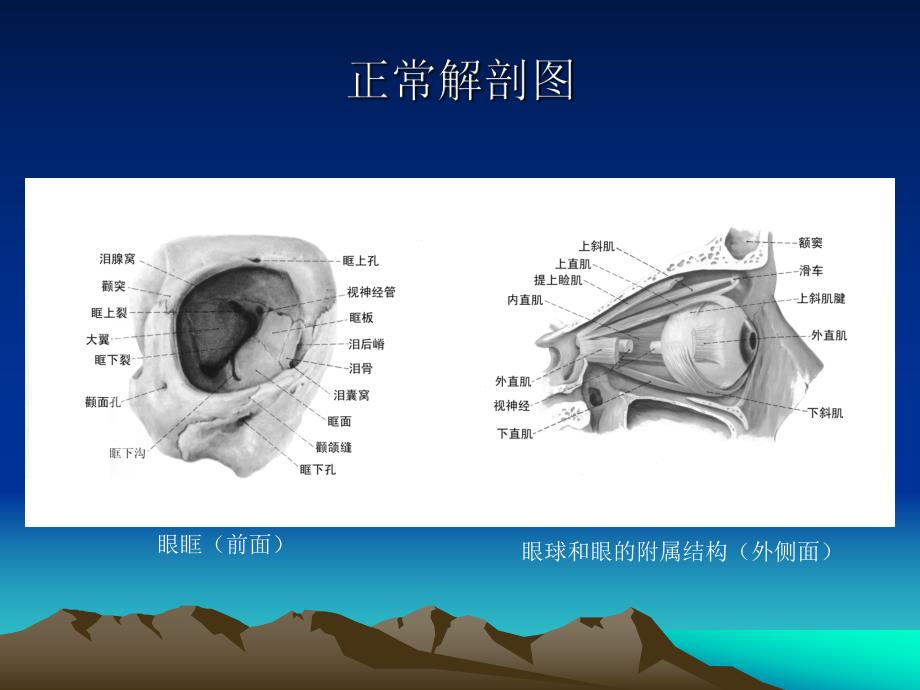 眼和眼眶的影像学诊断.ppt_第3页