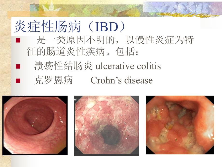 炎症性肠病[指南].ppt_第2页