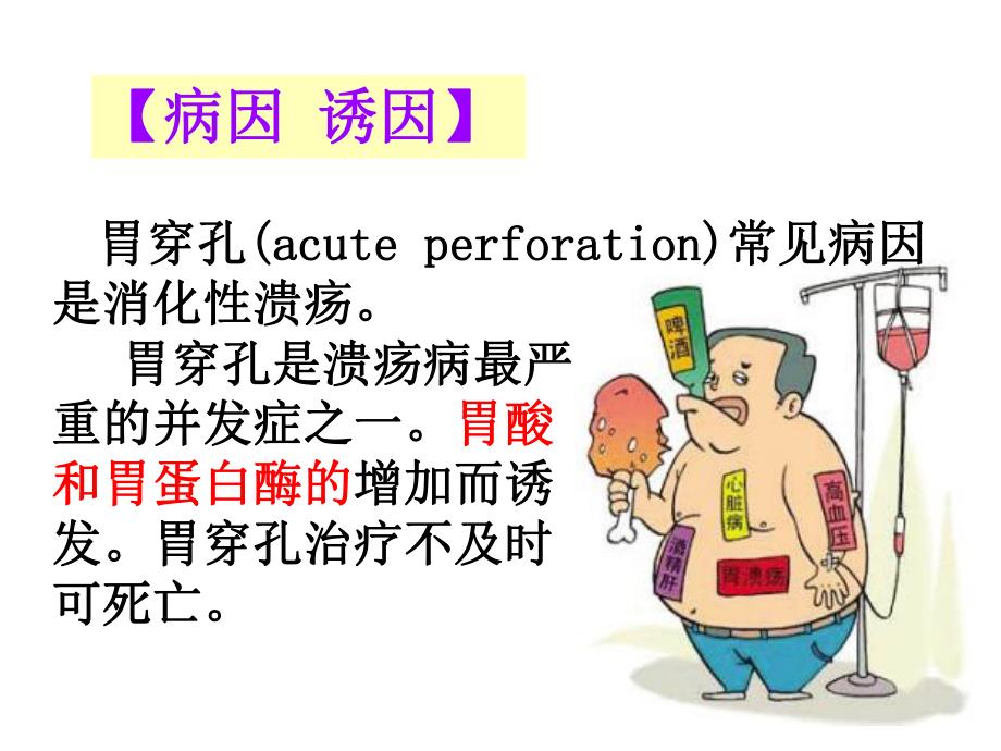 胃穿孔的护理外科讲课.ppt.ppt_第3页