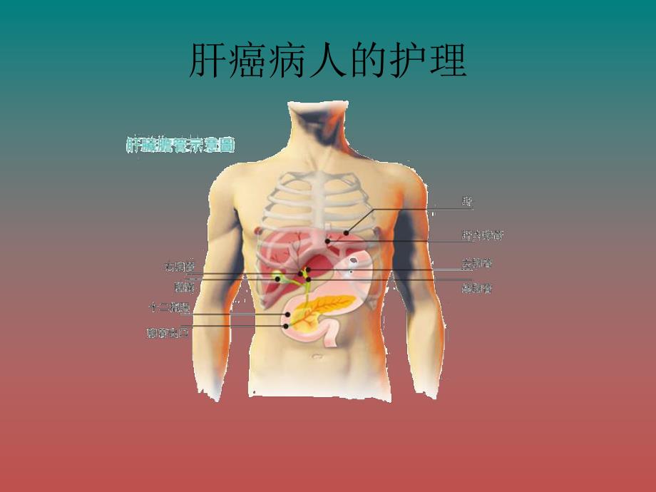 肝癌病人的护理ppt.ppt_第1页