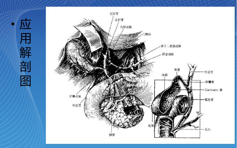 胆石症切除术护理查房.ppt_第3页