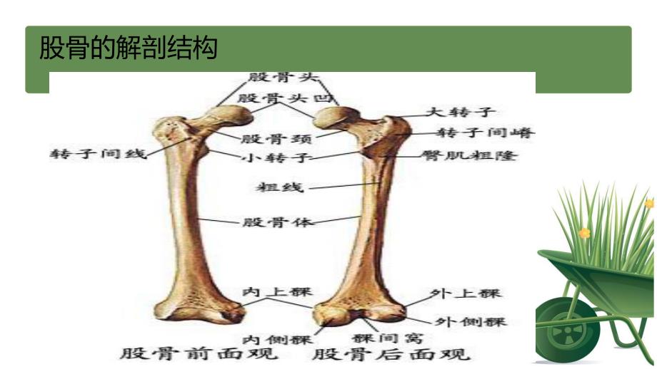 股骨颈骨折护理.ppt_第3页