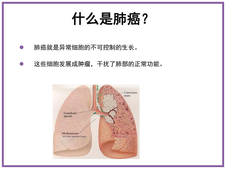 肺癌基础知识与预防.ppt_第3页