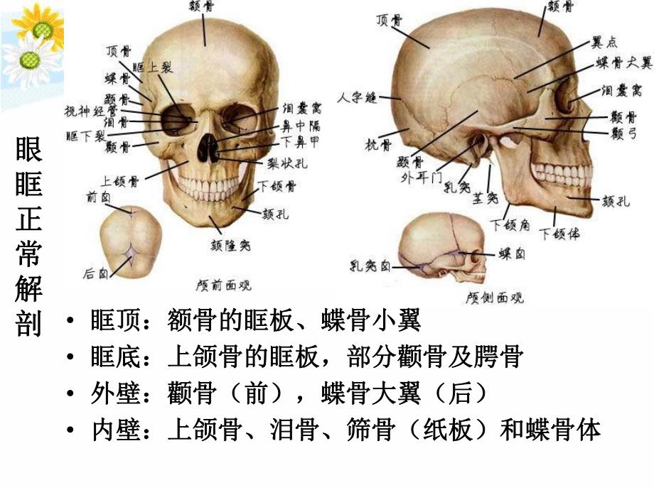 精品眼及眼眶疾病影像学诊断.ppt_第3页