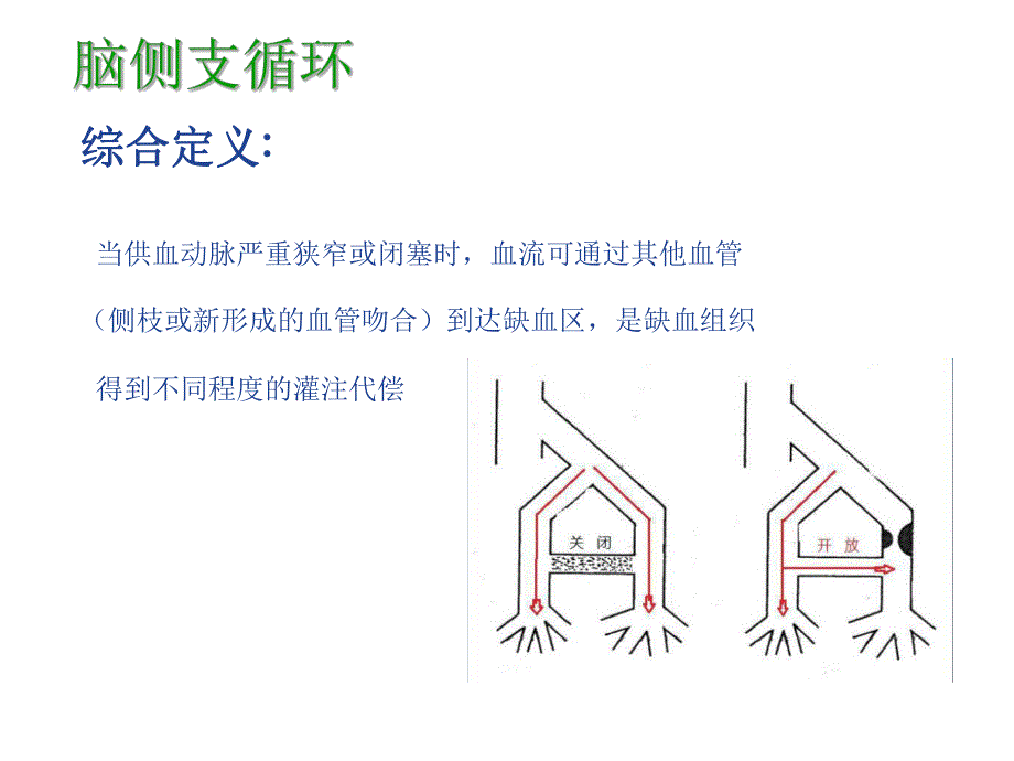 缺血性脑卒中的侧支循环评估.ppt_第2页