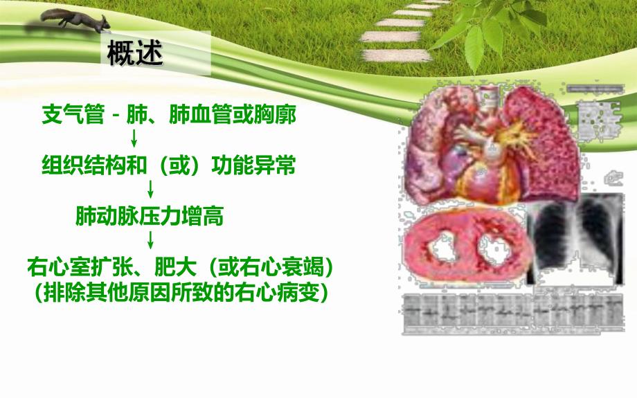 肺源性心脏病病人的护理.ppt_第2页