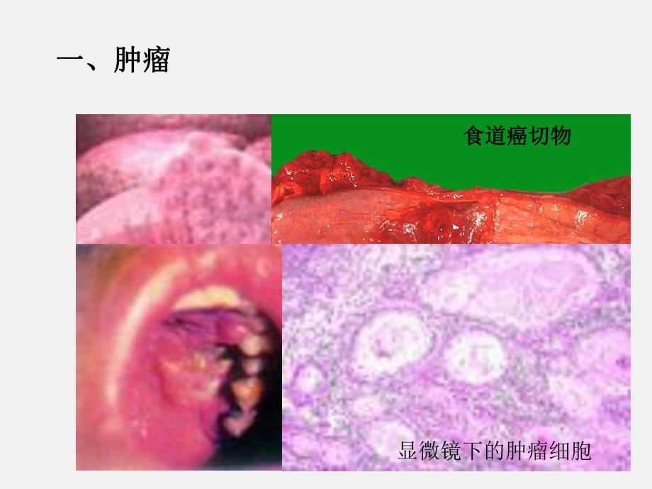 第四节非传染性疾病.ppt_第2页