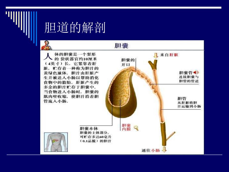 胆道结石业务查房.ppt_第3页