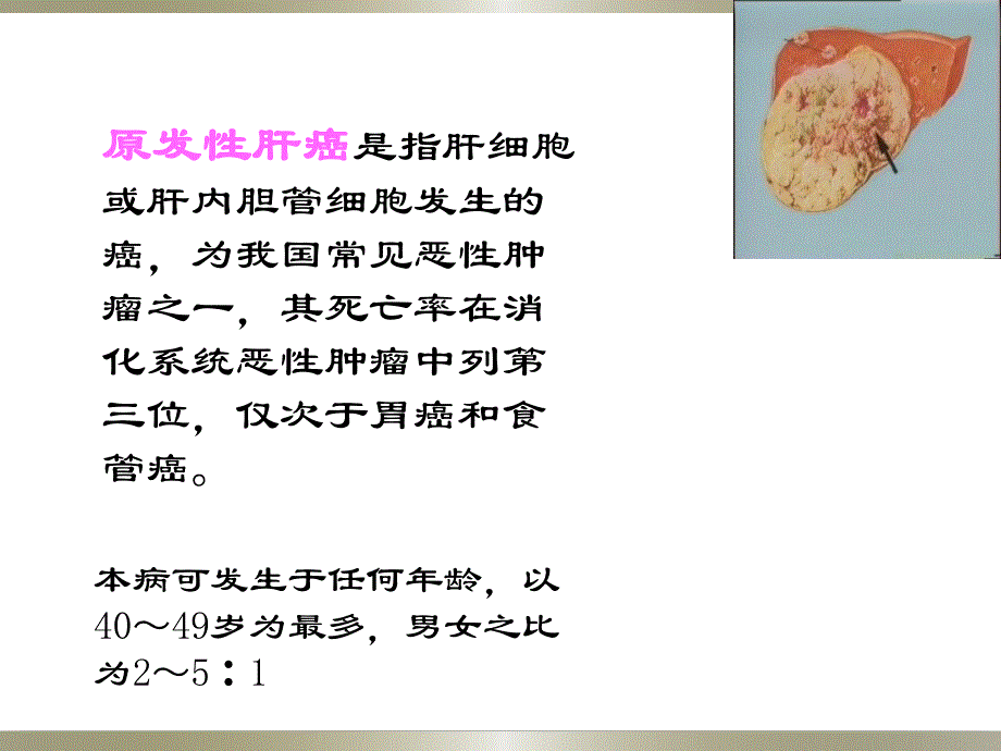 肝癌的护理医学幻灯片.ppt_第3页