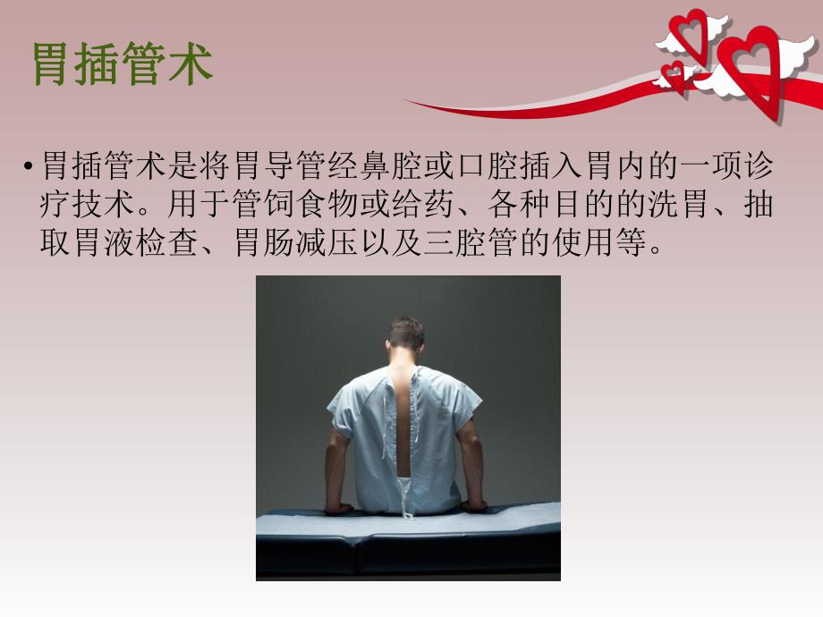 胃管护理终稿.ppt_第2页