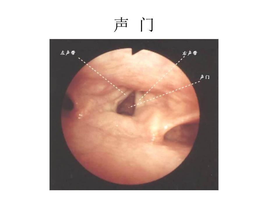 纤支镜的临床图谱.ppt_第2页