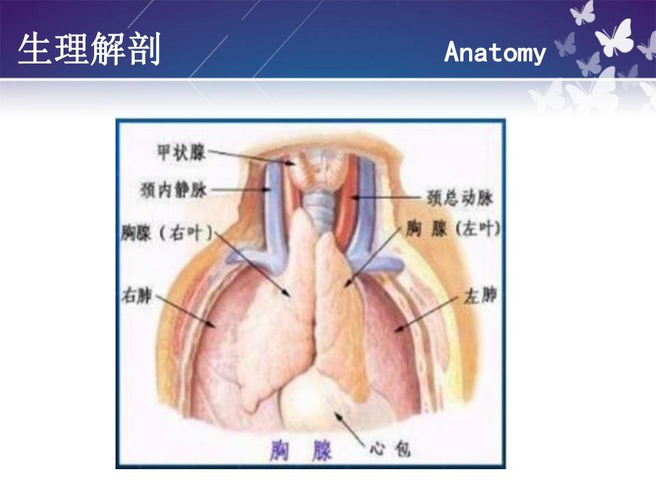 胸腺瘤的护理.ppt_第3页