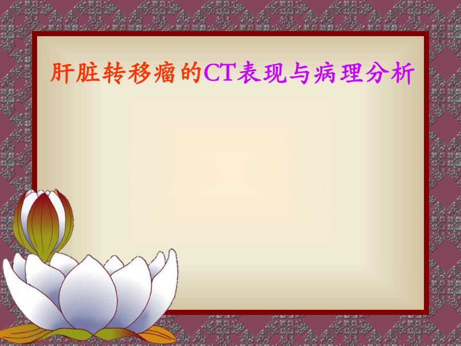 肝脏转移瘤的CT表现与病理幻灯.ppt_第1页