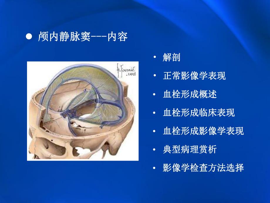 颅内静脉窦血栓形成的影像学表现.ppt_第2页