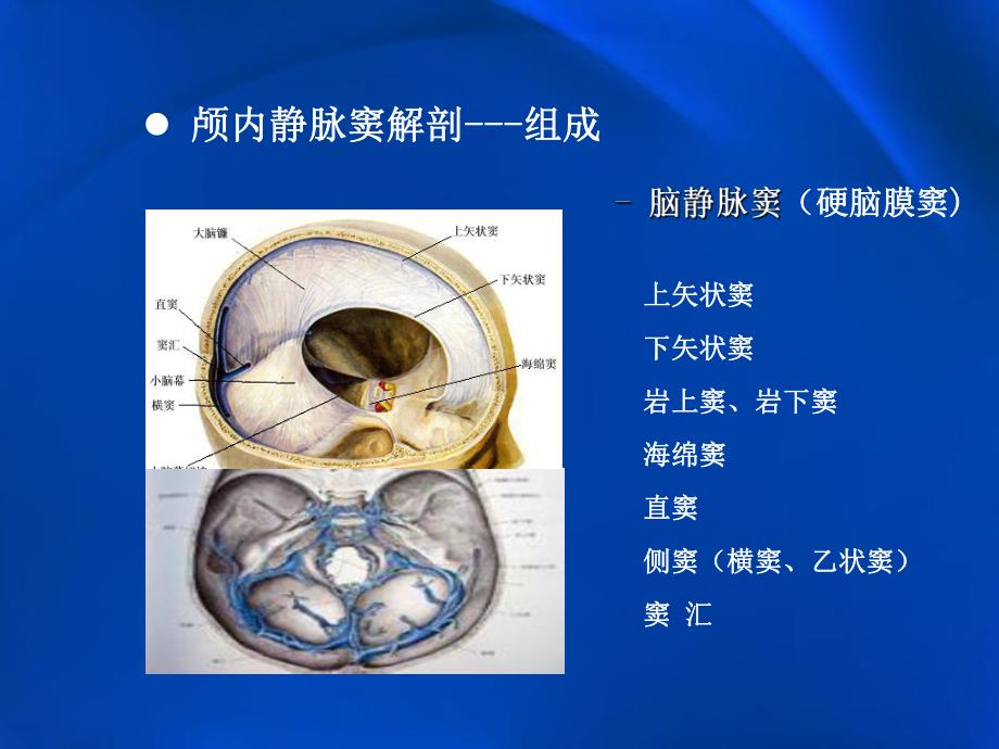 颅内静脉窦血栓形成的影像学表现.ppt_第3页