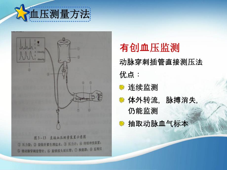 血压监测.ppt_第3页