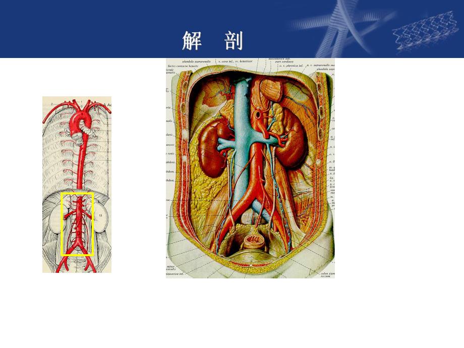 阜外大血管：腹部血管手术.ppt_第3页