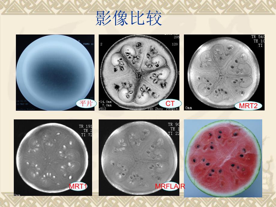 腹部影像的自我认识.ppt_第3页