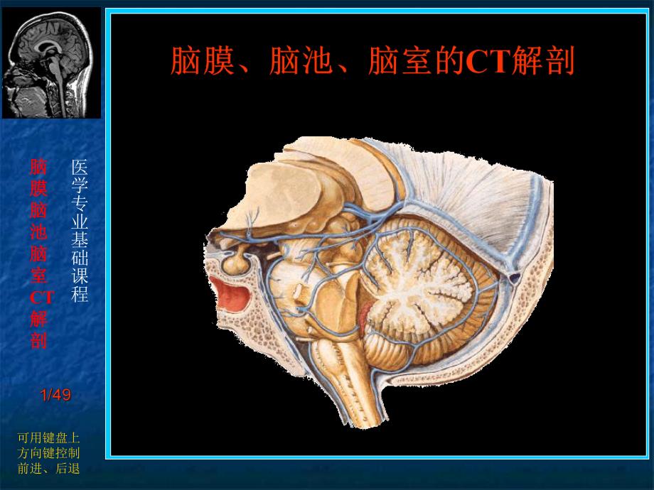 脑膜、脑池、脑室的CT解剖.ppt_第1页