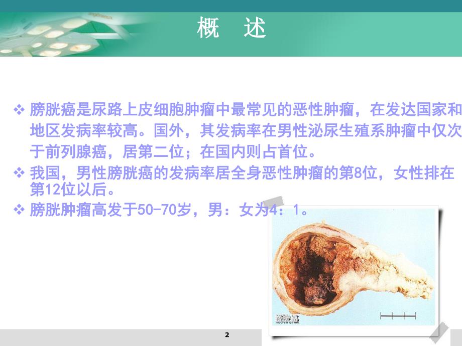 膀胱肿瘤病人的护理.ppt_第2页