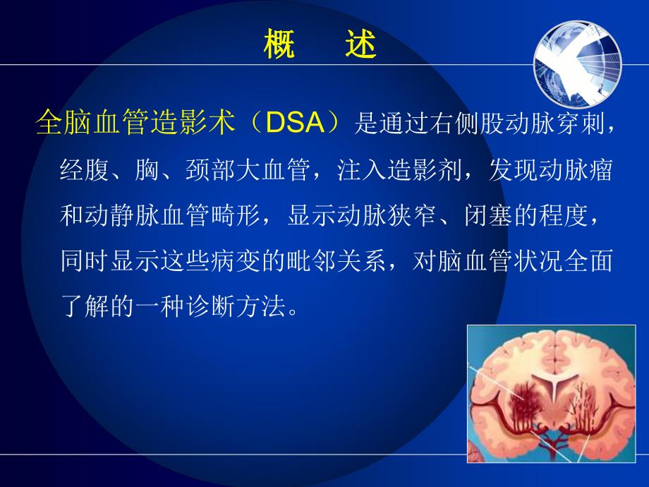 脑血管造影.ppt.ppt_第3页