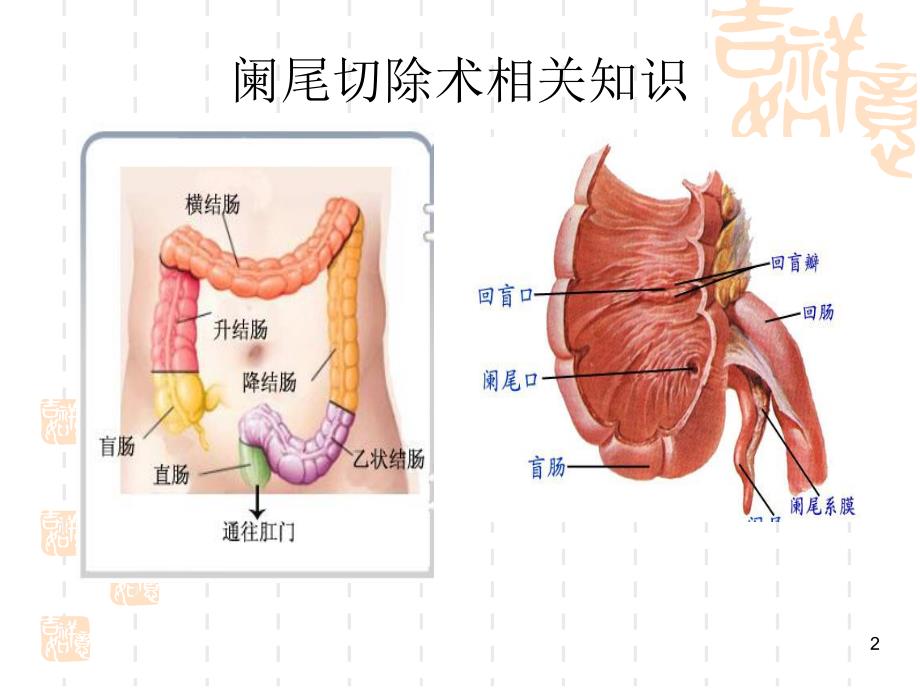 阑尾切除术相关知识及手术步骤【PPT】 .ppt_第2页