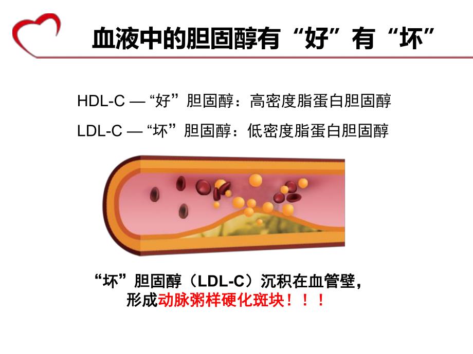 血脂健康教育.ppt_第2页