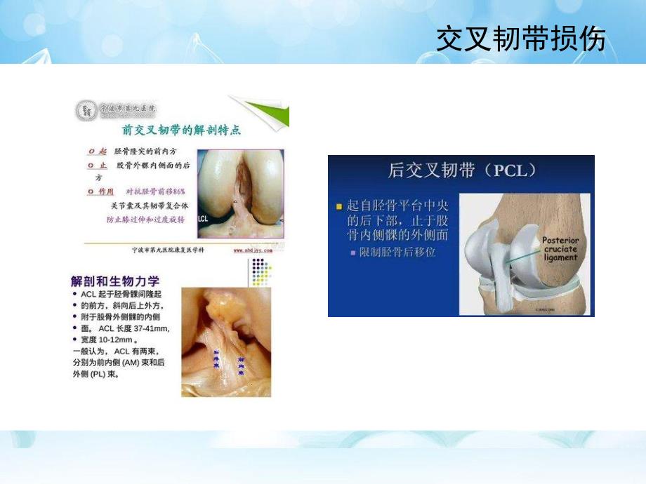 膝关节常见病.ppt_第3页