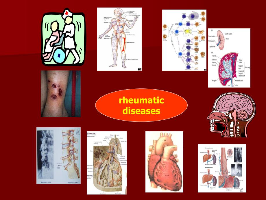 风湿免疫总论.ppt.ppt_第3页