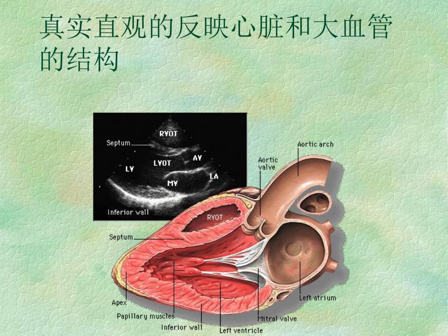 超声心动图在先天性心脏病诊疗中的应用.ppt_第2页