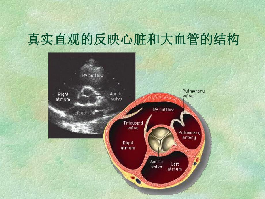 超声心动图在先天性心脏病诊疗中的应用.ppt_第3页