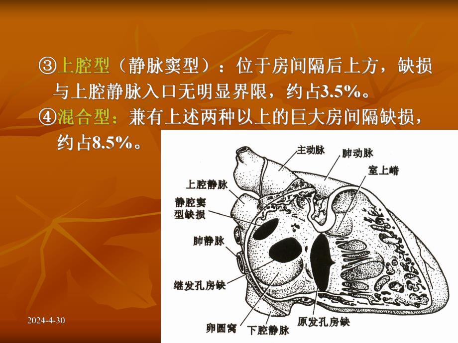 超声诊断学一先天性心脏病.ppt_第3页