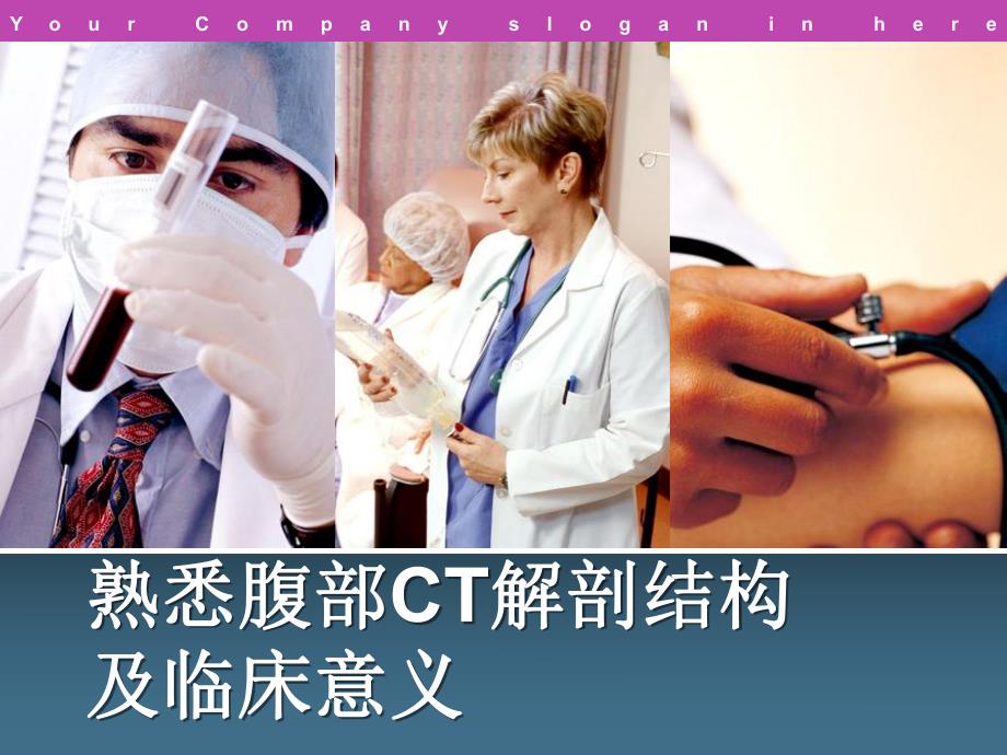 腹盆腔CT常见结构及临床意义讲座.ppt_第1页