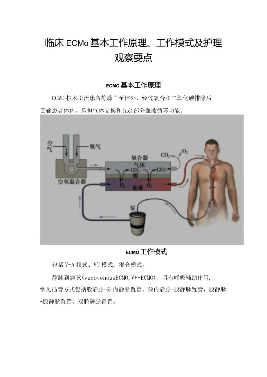 临床ECMO基本工作原理、工作模式及护理观察要点.docx_第1页