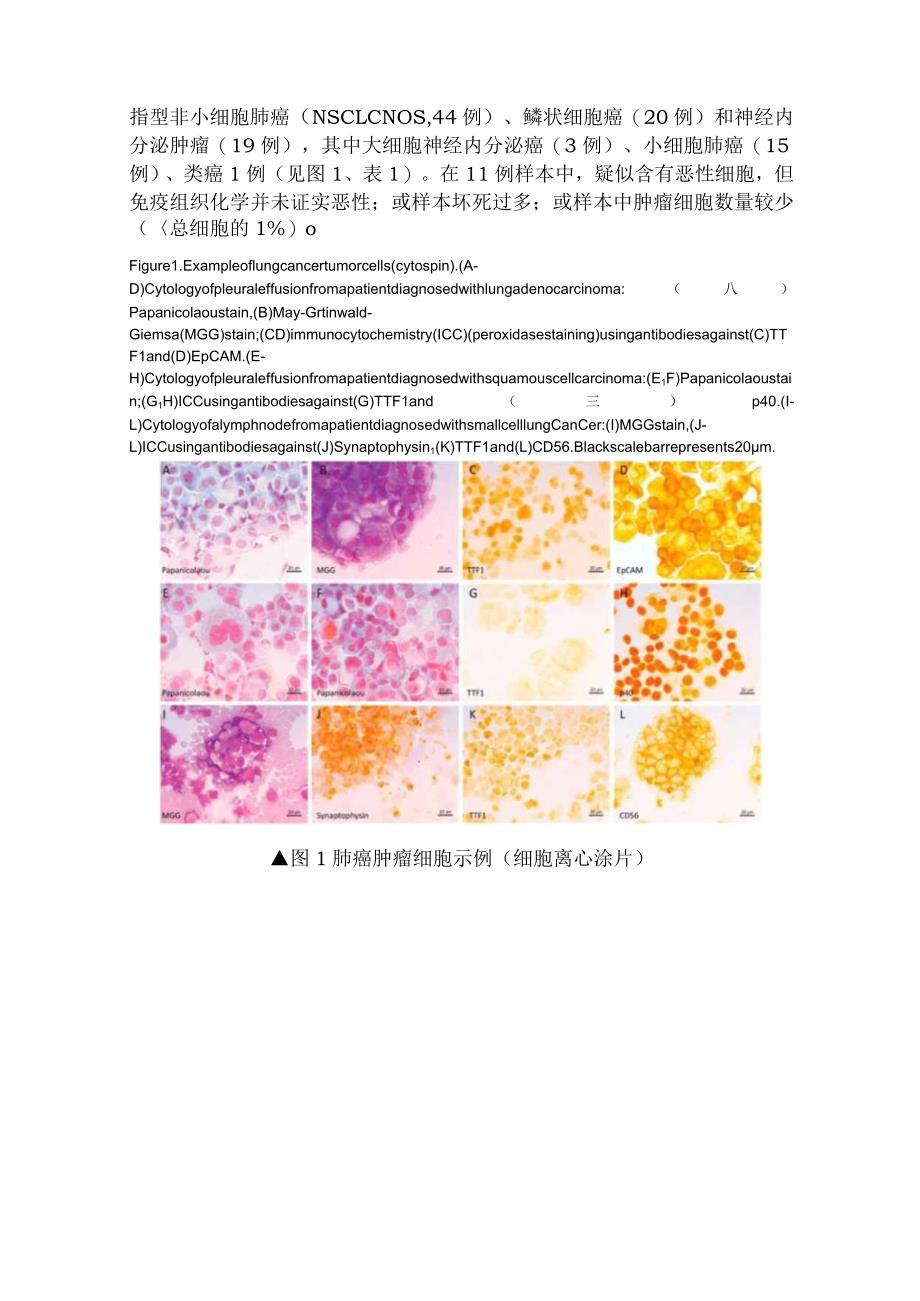 2024肺癌患者可用细胞学样本进行诊断、分子检测并指导治疗.docx_第3页