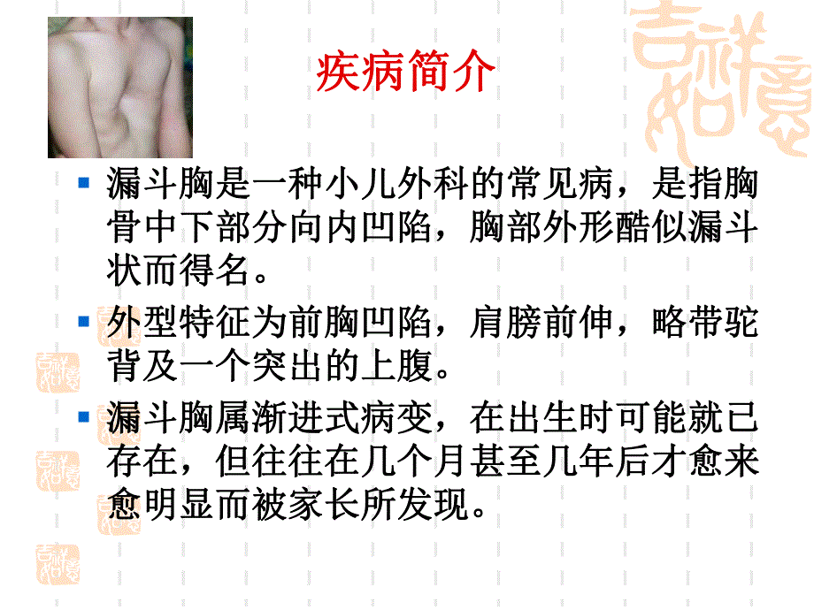 漏斗胸的护理.ppt_第2页