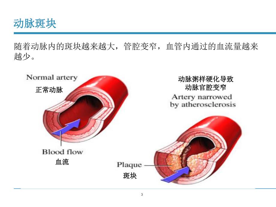 雅培心脏标志物.ppt_第3页