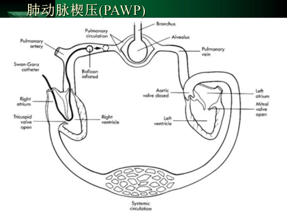 漂浮导管的临床应用.ppt_第2页