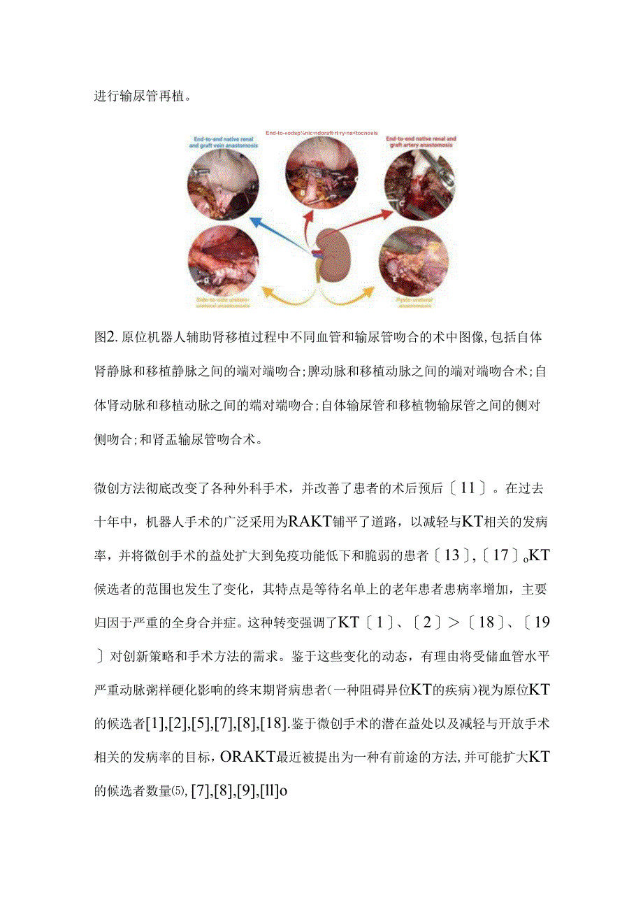 原位机器人辅助肾移植的手术技术和初步结果2024.docx_第3页