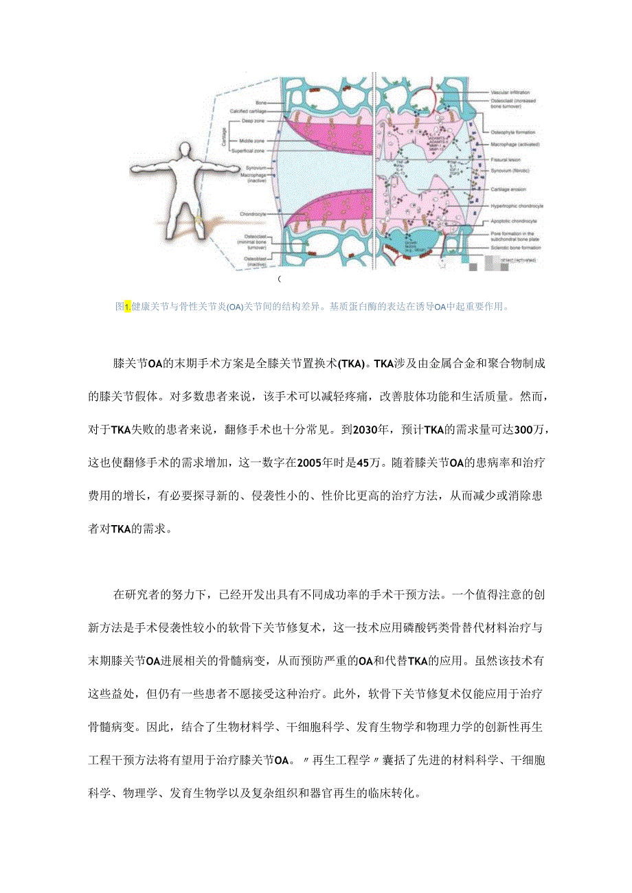 膝关节骨性关节炎治疗的再生工程.docx_第2页