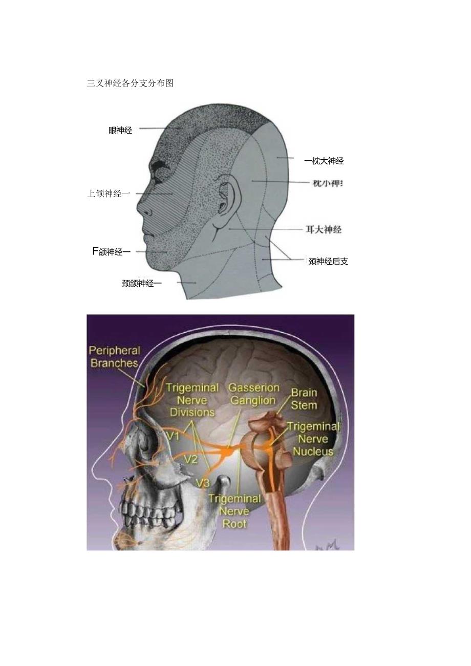临床三叉神经解剖、病因、疼痛特征、影像学扫描、鉴别诊断及治疗要点.docx_第3页