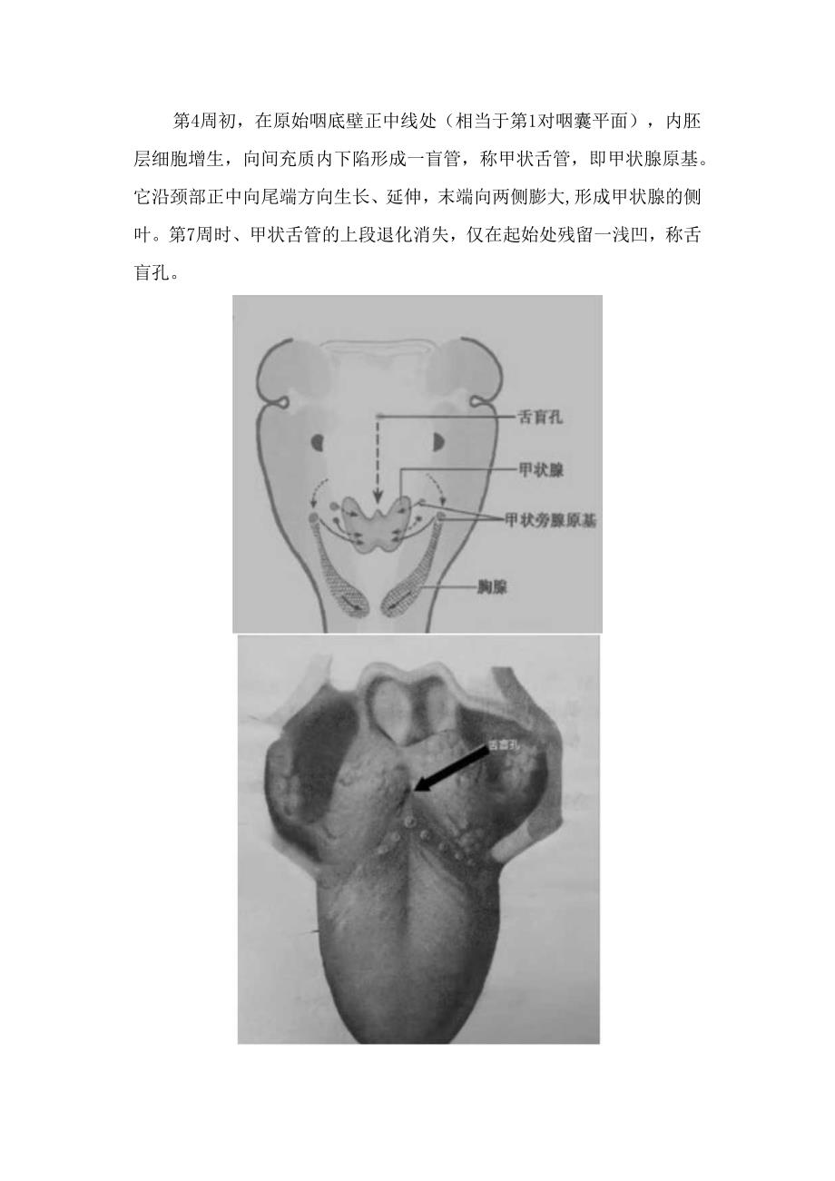 临床甲状舌管囊肿病例、发生原因、临床表现、超声表现、鉴别诊断及治疗措施.docx_第3页