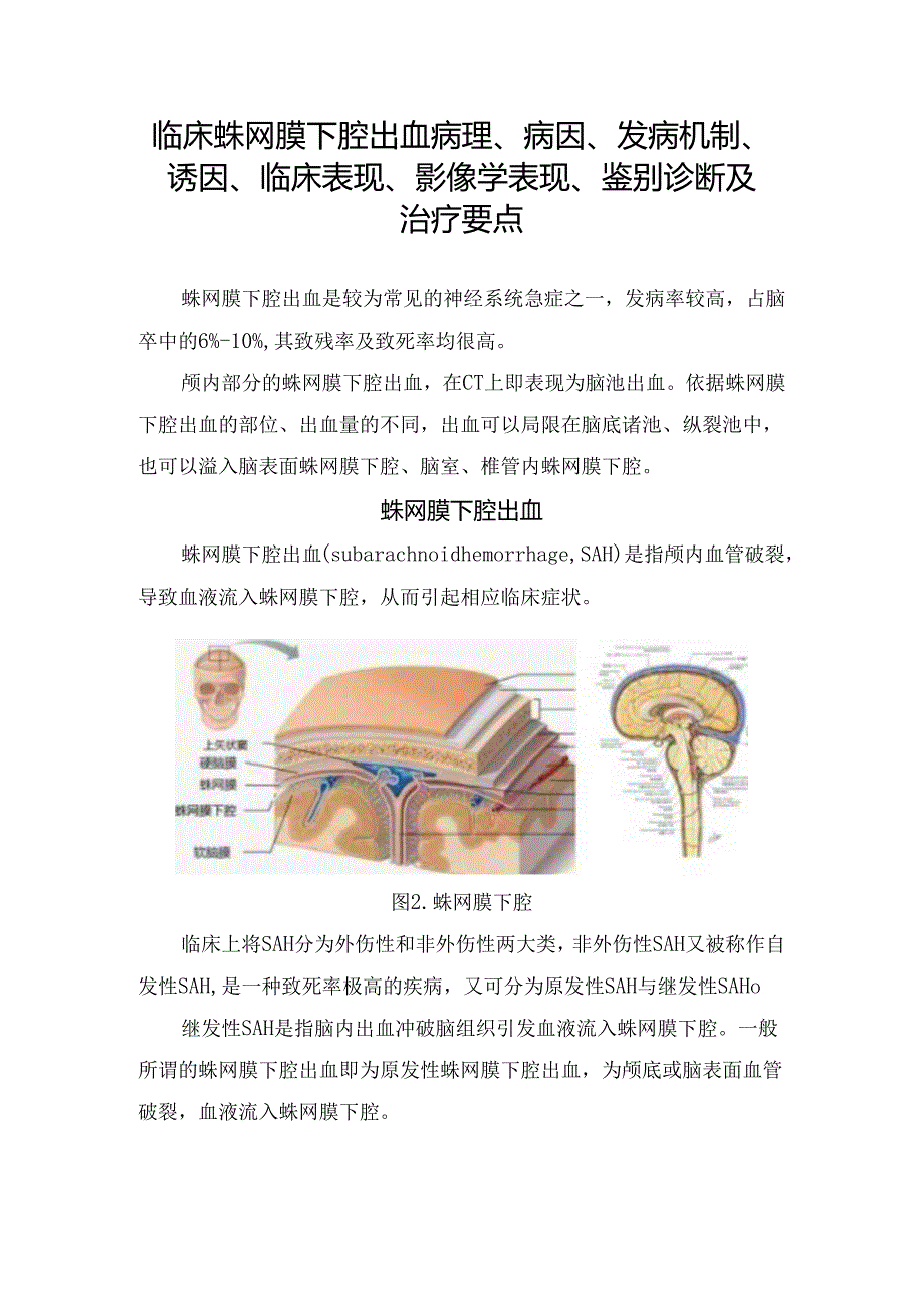 临床蛛网膜下腔出血病理、病因、发病机制、诱因、临床表现、影像学表现、鉴别诊断及治疗要点.docx_第1页