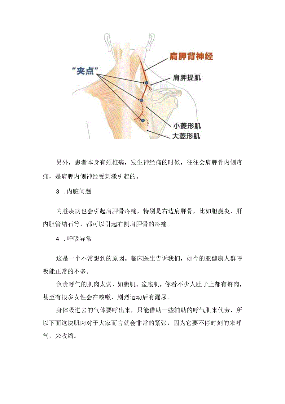 临床肩胛骨位置、肩胛骨缝疼痛原因及治疗方式.docx_第3页